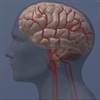 3 approaches may help prevent cognitive decline and dementia 3 approaches may help prevent cognitive decline and dementia