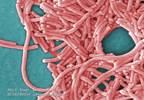 7 dead from Legionnaires' at veterans' home 7 dead from Legionnaires' at veterans' home