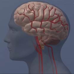 Computer chips to improve cognition not appealing: survey Computer chips to improve cognition not appealing: survey