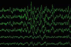 Brain waves during slow-wave sleep are measured as a study participant sleeps. (Image: Yo-El Ju) Brain waves during slow-wave sleep are measured as a study participant sleeps. (Image: Yo-El Ju)